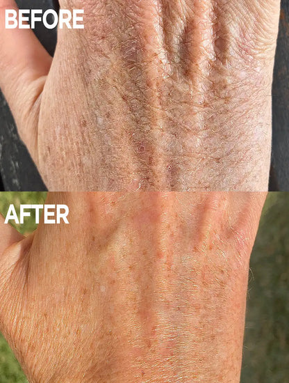Golden Dry Skin Miracle Salve - 60g